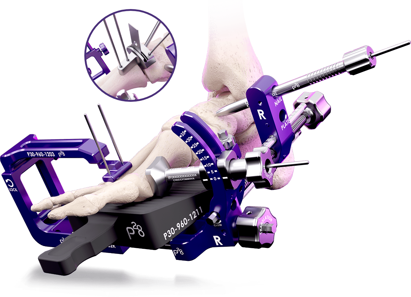 Bun Yo Matic with Labels Image