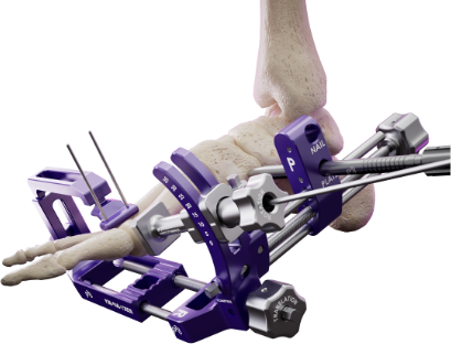 Introducing the  SMART Bun-Yo-Matic™