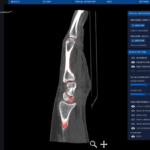 dicom-compare-model-new_orig Image